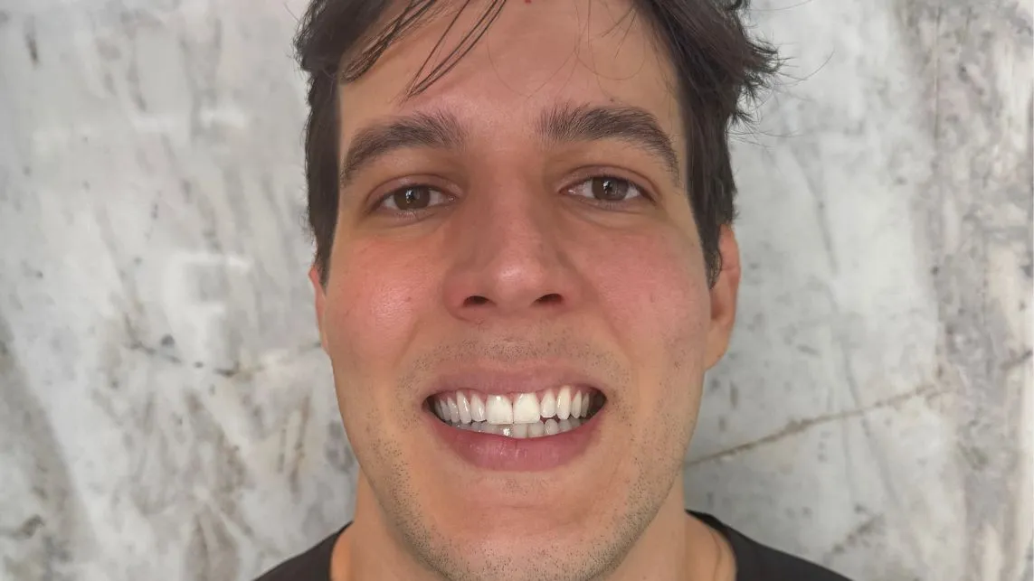 reabilitacao-oral-rio-vermelho-_1_