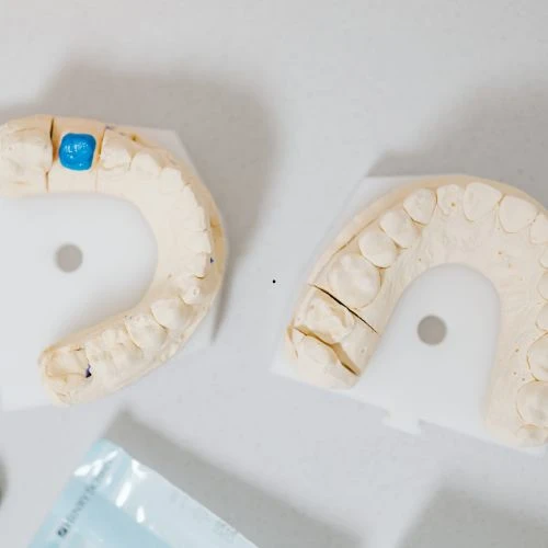 Coroas dentárias em porcelana no Rio Vermelho para reabilitação oral