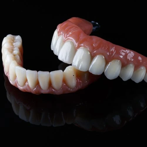 Prótese dentária total ou parcial no Rio Vermelho para reabilitação oral