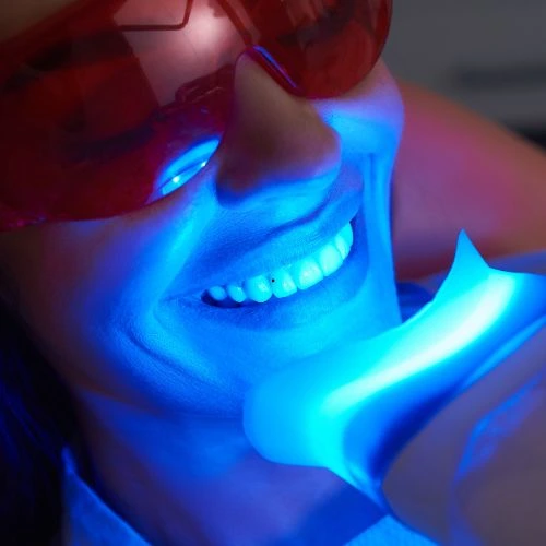 Clareamento dental a laser no Rio Vermelho com resultado natural