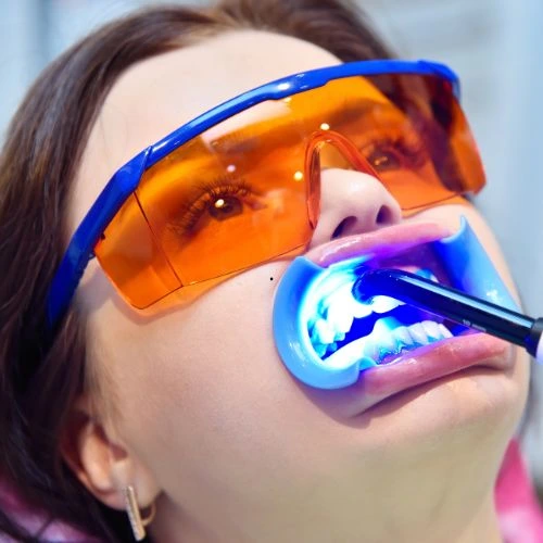 Indicação para clareamento dental no Rio Vermelho