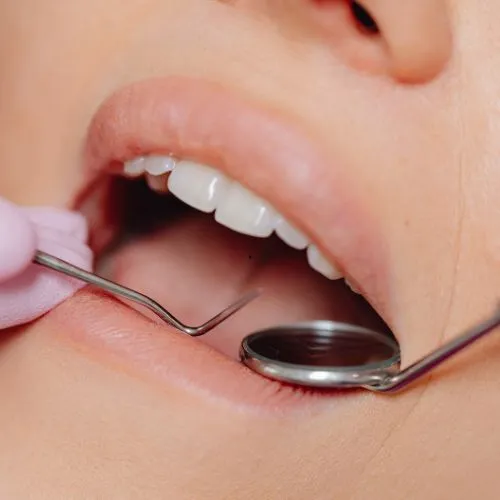 Indicação para limpeza e profilaxia dental no Rio Vermelho