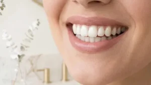 Quanto tempo dura o clareamento dental? Entenda o que esperar